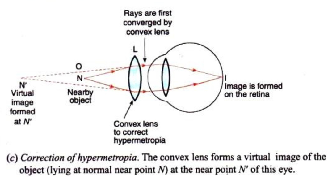 Defects of Vision and their Correction Class 10, The Human Eyes and